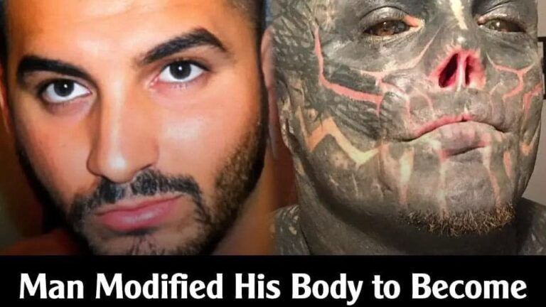 A Person Dubbed ‘world’s Most Modified Man’ Reveals How He Looked Before All The Surgeries