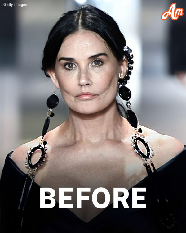 Demi Moore, 61, Appears to Be ‘Aging Backwards’ in Recent Pics – Aesthetics Doctor Weighs In