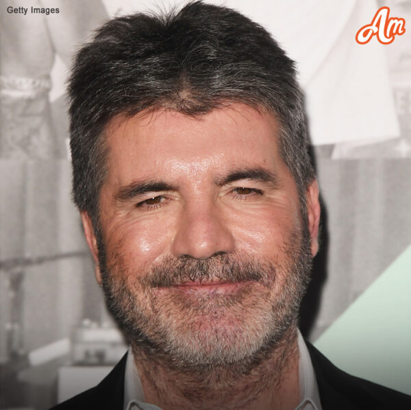Simon Cowell se quitó los rellenos faciales después de que su hijo tuviera un ataque de histeria: fotos de antes y después