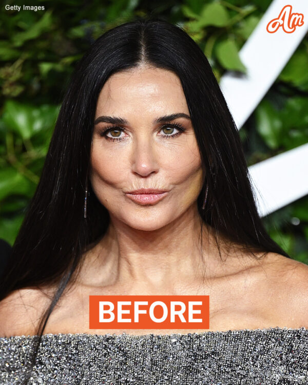 What Demi Moore, 61, Has Done to Her Face to Look Like She’s ‘Aging Backwards,’ According to a Cosmetic Doctor