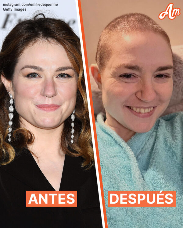 Émilie Dequenne muere a los 43 años – Su último mensaje desgarrador