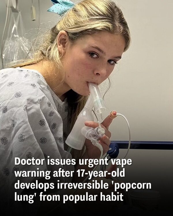 Urgent Vape Warning Issued By Doctor After 17-Year-Old Develops Permanent ‘Popcorn Lung’