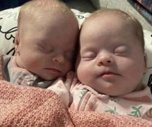 Mom Celebrates Unique Journey of Her Rare Twins with Down Syndrome