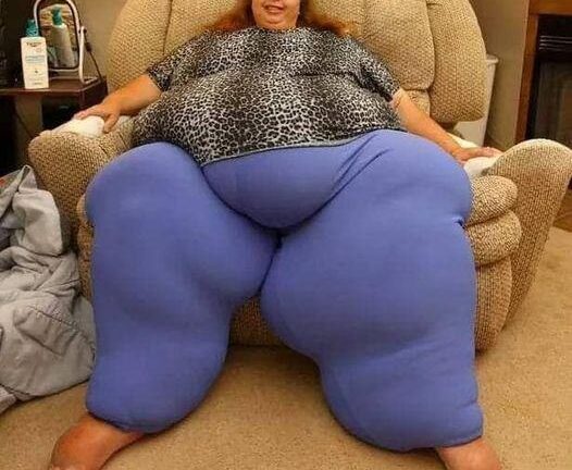 Woman Loses 518 lbs And The After Pictures Are Mind-Blowing