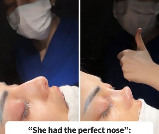Woman Goes Viral After They Botched Her Nose Job Terribly