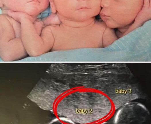 Young mom overcomes huge odds, gives birth to miracle triplets