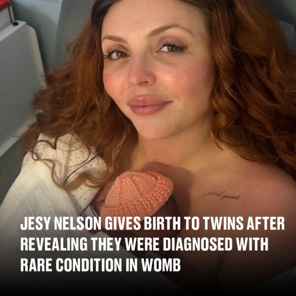 Jesy Nelson gives birth to twins after revealing they were diagnosed with rare condition in womb