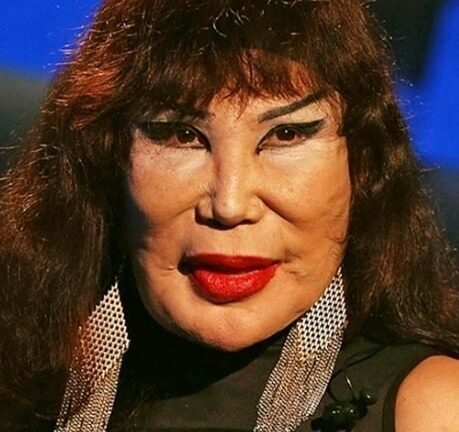 “Who Is She?”: How One Tragic Mistake Changed the Look of a Famous Actress Who Starred in Around 100 Films!