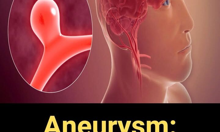 12 Early Warning Signs of an Aneurysm You Shouldn’t Ignore