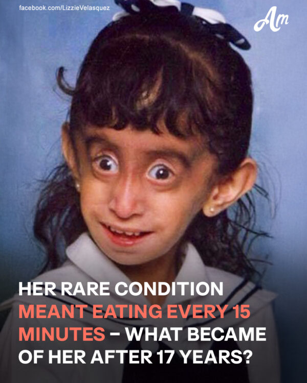 She Has to Eat Every 15 Minutes to Stay Alive – Here’s What She Looks like Today