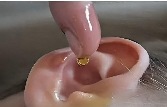 Uma gota desobstrui o ouvido, melhora os problemas de audição e elimina o desconforto
