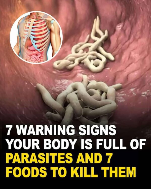 7 Signs Of Intestinal Parasites Living Inside Your Body