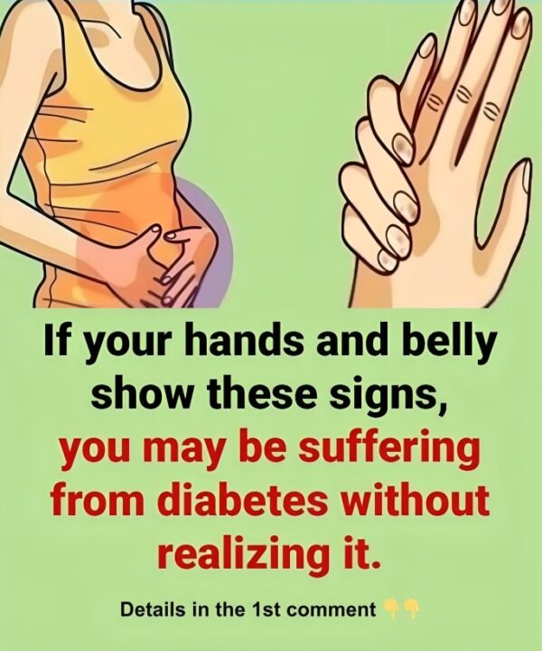 If your hands and belly show these signs, you may be suffering from diebetes without realizing it