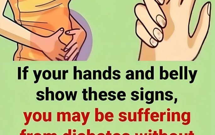 If your hands and belly show these signs, you may be suffering from diebetes without realizing it