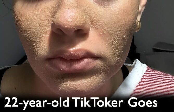 22-year-old goes viral for never washing her face