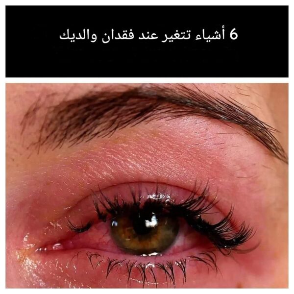 ست حقائق قاسية عن فقدان أحد الوالدين