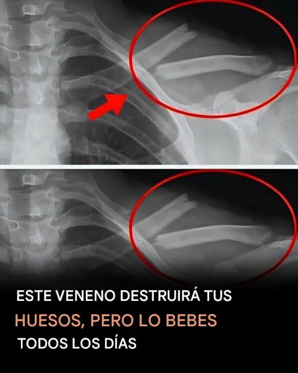 8 efectos perjudiciales que los refrescos pueden tener en tu cuerpo