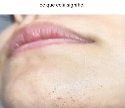 Ces poils au menton disgracieux ? Voici ce que votre corps pourrait vous dire.