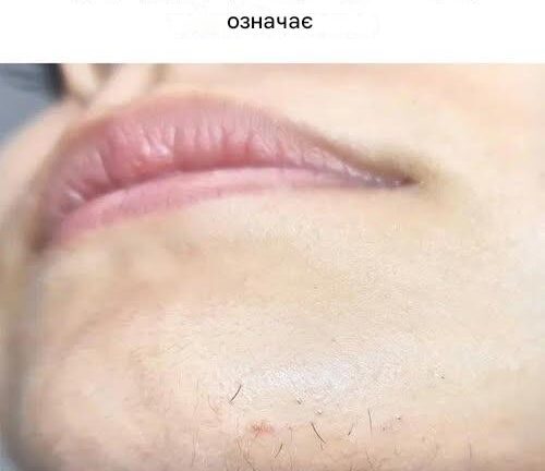 Набридливе волосся на підборідді? Ось що може говорити вам ваше тіло