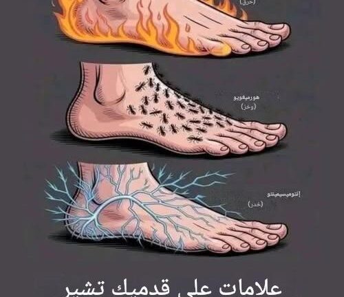 علامات على قدميك تشير إلى