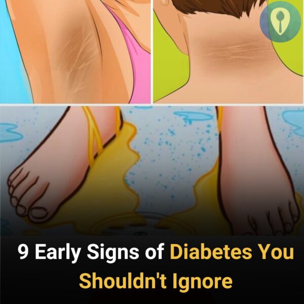 9 Early Signs of Diabetes You Shouldn’t Ignore