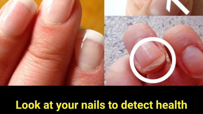 Look at your nails to detect health problems
