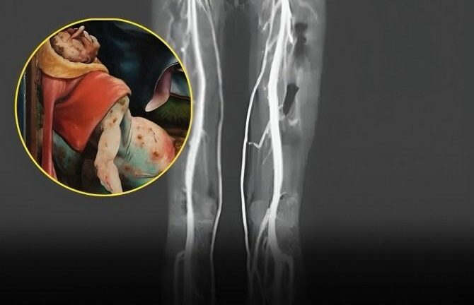 Woman Experiencing Burning Pains Turns Out To Have Medieval ‘Holy Fire’ Disease