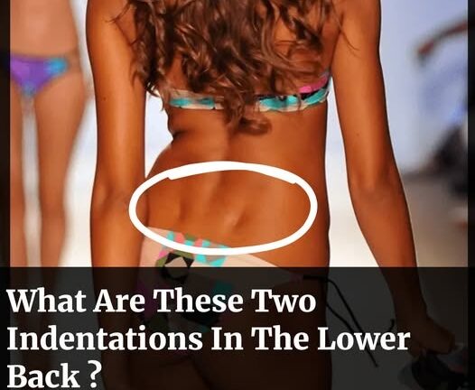 The Mystery of Lower Back Dimples: What You Need to Know