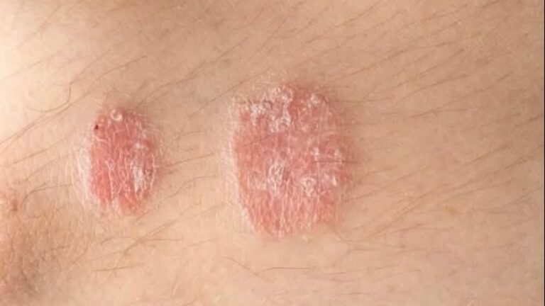 Warning signs you should never ignore on your skin