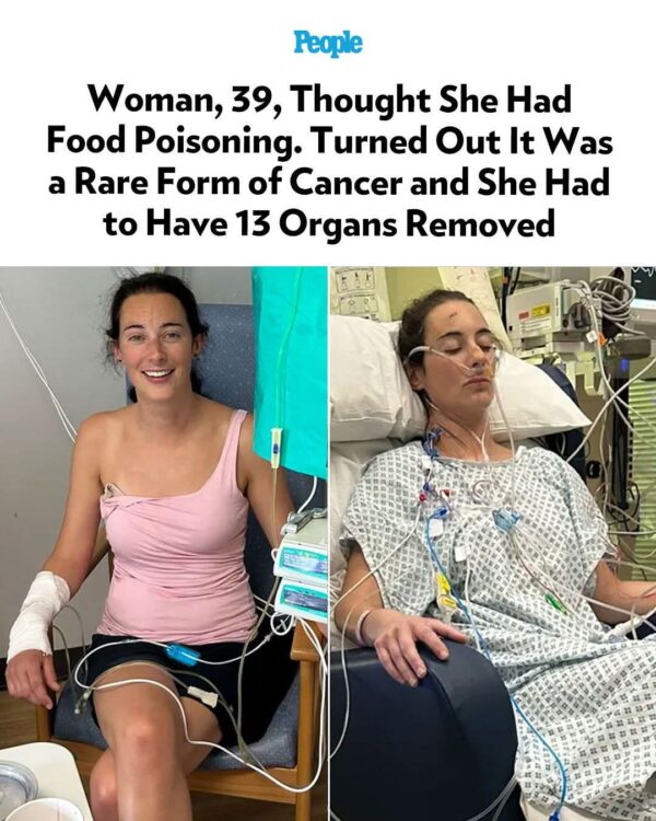 Woman’s Stomach Pain Turns Out to Be Rare Can.cer