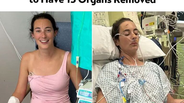 Woman’s Stomach Pain Turns Out to Be Rare Can.cer