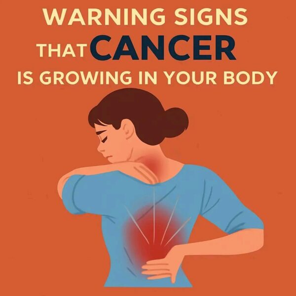 20 Early Signs That Cancer Is Growing In Your Body