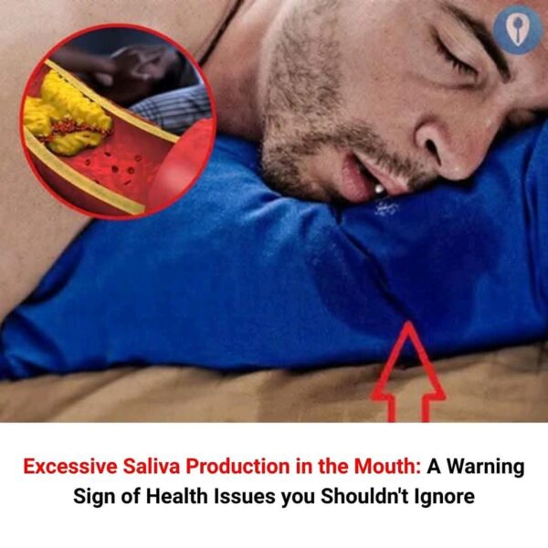 Excessive Saliva Production in the Mouth: A Warning Sign of Health Issues you Shouldn’t Ignore