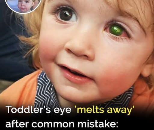 Toddler’s eye ”melts away” after wrong person kissed him