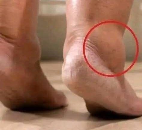 These are the signs that he is cr… See more