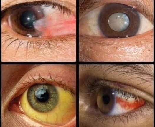 “Hidden Clues in Your Eyes That Reveal…”