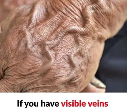 Why Veins Become More Visible with Age
