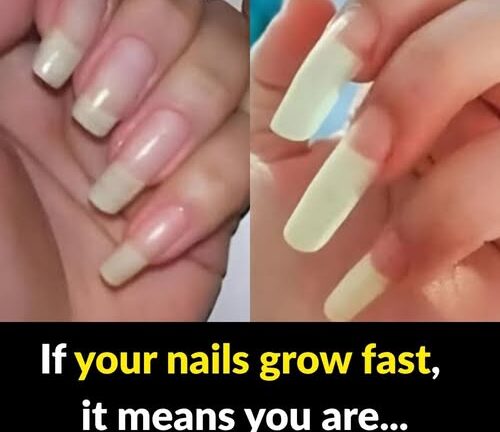 What It Really Means If Your Fingernails Grow Fast