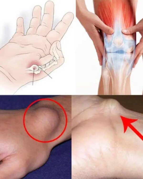 A cyst on the foot or wrist: What should you do?