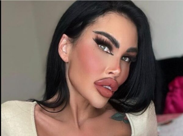 Plastic surgery addict spends $200K on plastic surgery. How she looks before will shock you