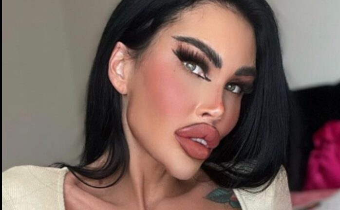 Plastic surgery addict spends $200K on plastic surgery. How she looks before will shock you