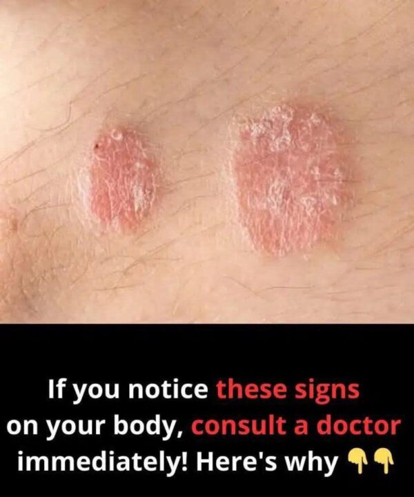 If You Notice These Signs on Your Body, Consult a Doctor Immediately