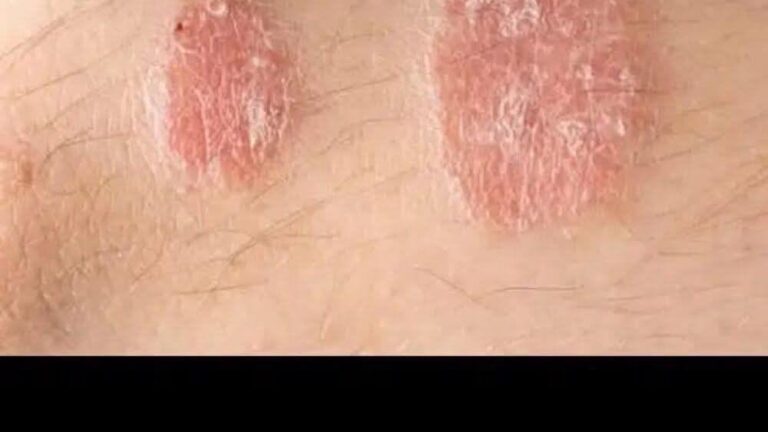 If You Notice These Signs on Your Body, Consult a Doctor Immediately