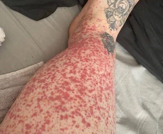 These are the consequences of eating …See more