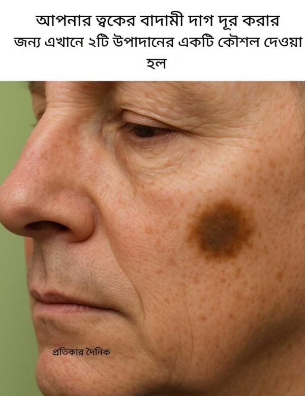 আপনার ত্বকের বাদামী দাগ দূর করার জন্য এখানে ২টি উপাদানের একটি কৌশল দেওয়া হল