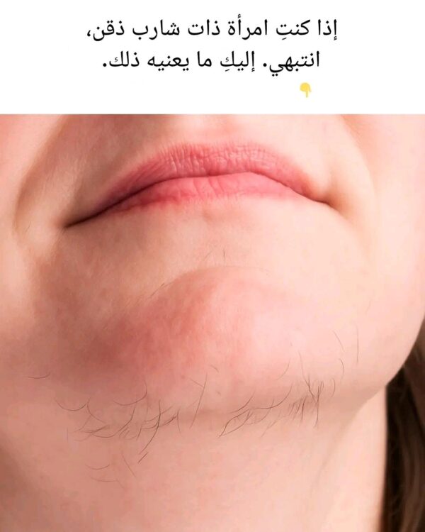فهم شوارب الذقن لدى النساء وإدارتها: الأسباب والآثار والحلول