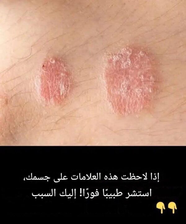 إذا لاحظت هذه العلامات على جسمك، استشر طبيبًا فورًا