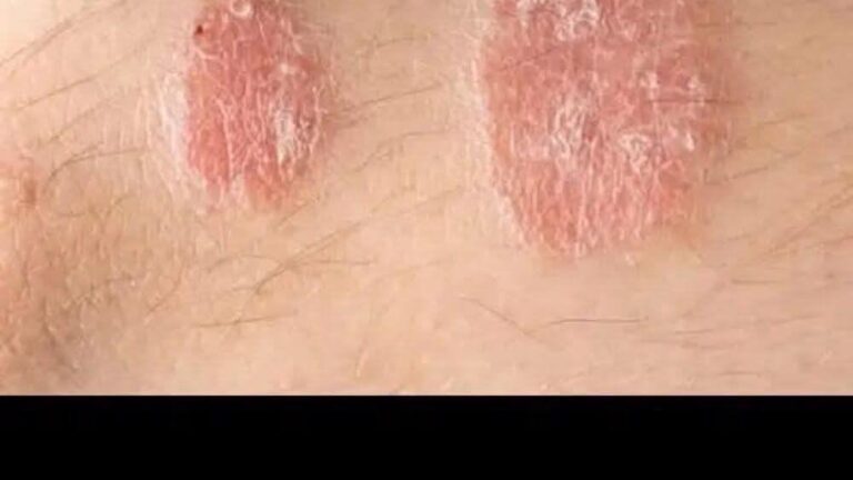 إذا لاحظت هذه العلامات على جسمك، استشر طبيبًا فورًا