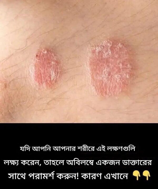 যদি আপনি আপনার শরীরে এই লক্ষণগুলি লক্ষ্য করেন, তাহলে অবিলম্বে একজন ডাক্তারের সাথে পরামর্শ করুন