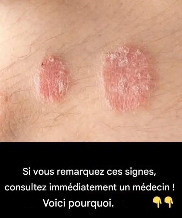 Si vous remarquez ces signes sur votre corps, consultez immédiatement un médecin.